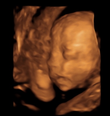 3D Baby Image Face